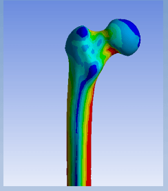 Evaluation of Loads Induced on Leg Lemur Joint by Running